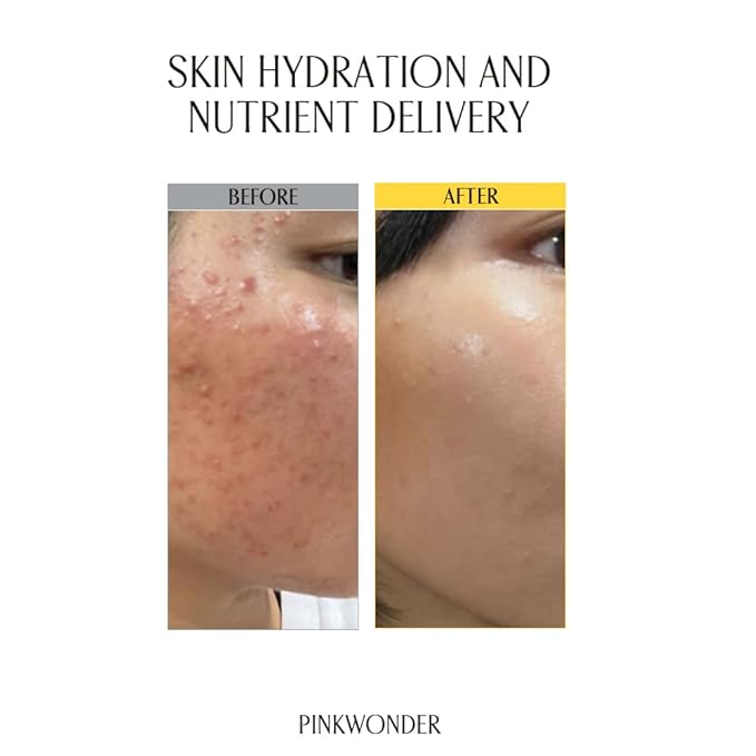 PINKWONDER USDA Organic Jojoba Oil (6.76oz, Jojoba Toner)