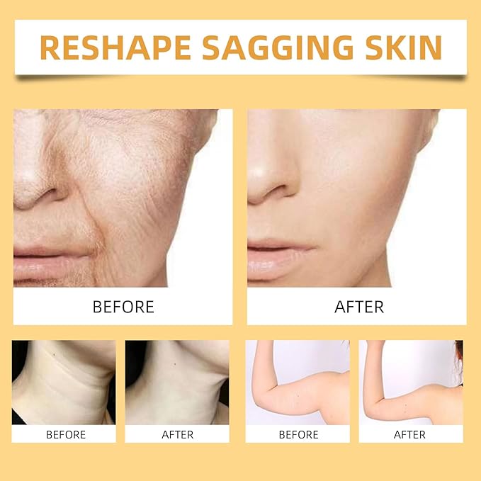 Bee Venom Firming Serum Stick, 2PCS Anti-Aging Face Cream, Lifts and Tightens the Skin, Hydrating, Lifting & Restoring Skin Elasticity, Bee Venom Body Tightening Cream for Women & Men