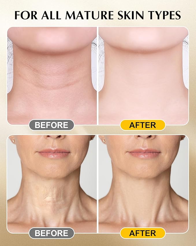 Neck Firming Cream with 3% Retinol - Hyaluronic Acid, Anti-Wrinkle Treatment, Skin Tightening Cream for Face, Neck, Chest & Décolleté