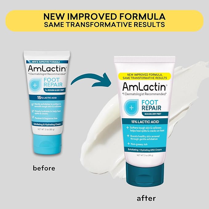 AmLactin Foot Repair Cream - 3 oz Cream for Dry Cracked Heels with 15% Lactic Acid - Exfoliator and Moisturizer for Dry Skin (Packaging May Vary)