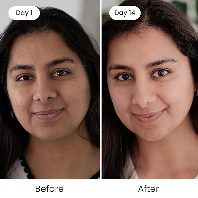 Shankara Kumkumadi Oil with Pure Saffron and Ayurvedic Herbs (Original Aroma 18ml)