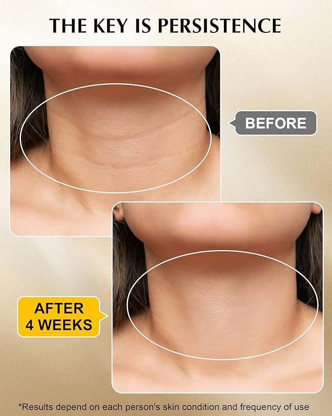 Neck Firming Cream with 3% Retinol - Hyaluronic Acid, Anti-Wrinkle Treatment, Skin Tightening Cream for Face, Neck, Chest & Décolleté