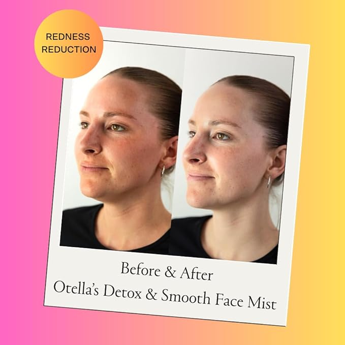 Detox & Soothe Face Mist with Hypochlorous Acid | Reduces Redness & Breakouts | pH Balance & Skin Cleansing for Active Lifestyles | TSA Approved, 2.7 oz | Clean Ingredients