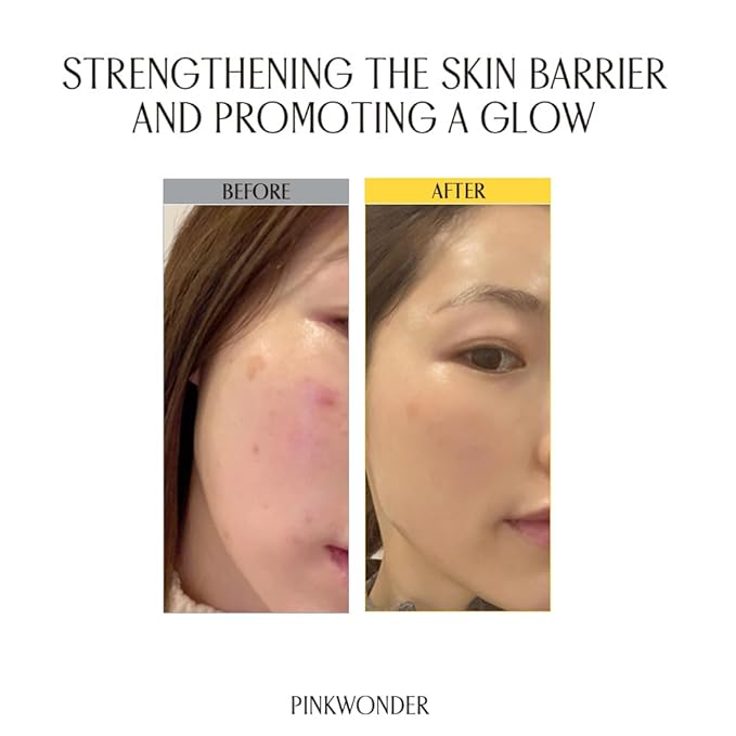 PINKWONDER Jojoba Vita Cream 3.38oz (100ml), Jojoba Oil and vitamin B12 Face Cream, Soothing for Sensitive Skin, Hypoallergenic, Korean Skincare