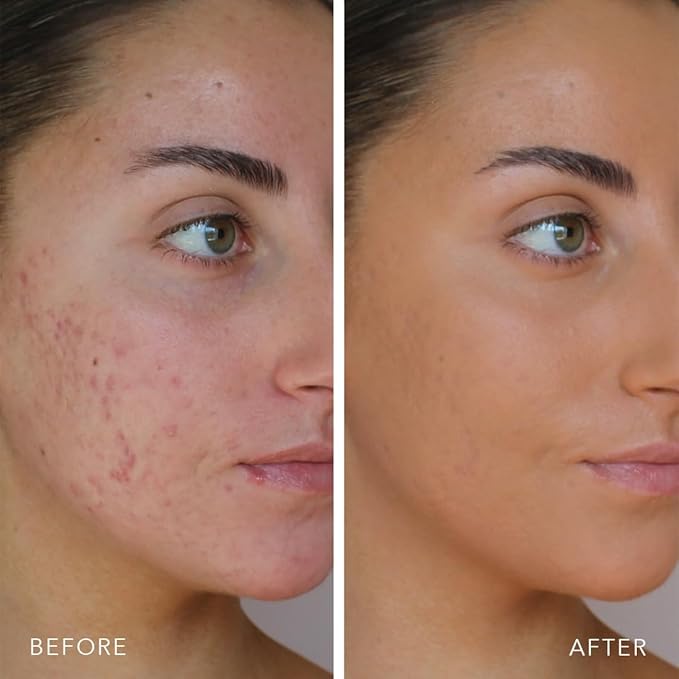 Doll 10 TCE Liquid Filter - Covers, Blurs, and Brightens (Fair)