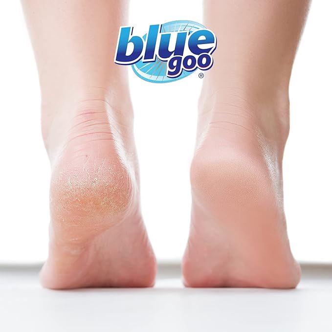 Blue Goo Cracked Heels & Dry Hands Intense Skin Softener - for Calluses, Corns & Elbow Dryness Relief, Fast- Penetrating Hydrating Moisturizer, Made w/ 100% Pure Emu Oil & Beeswax, 2 oz (2 Pack)