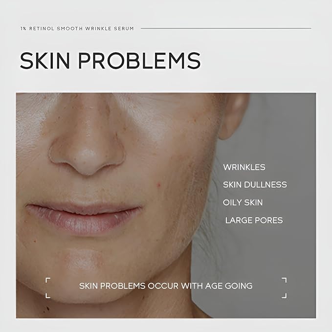 1% Retinol Serum for Face, Facial Serums for Anti Aging with Retinol, Niacinamide & Vitamin E for Fine Lines, Wrinkles & Dark Spots, Daily Skincare to Smooth & Firm Skin, 1.06 fl. oz, Pack of 2