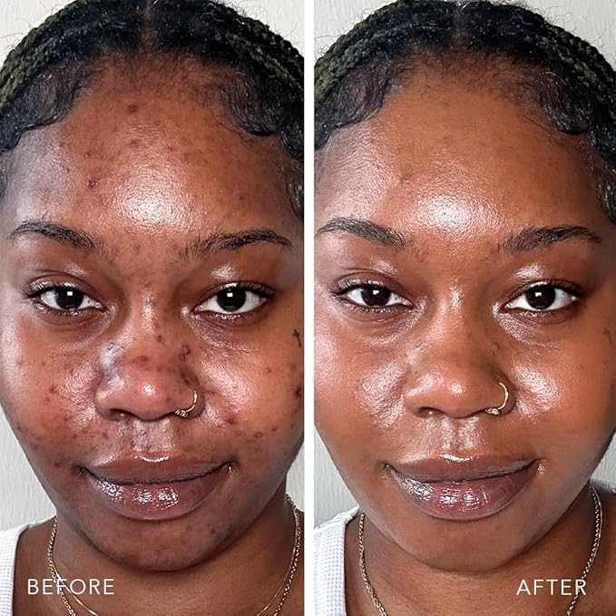 Doll 10 TCE Liquid Filter - Covers, Blurs, and Brightens (Rich)