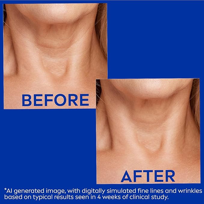 NIVEA Skin Firming & Anti Wrinkle Neck & Chest Cream with Coenzyme Q10, Creatine and Provitamin B5, Skin Firming Cream Reduces the Look of Fine Lines and Wrinkles, 6.7 Oz Tube