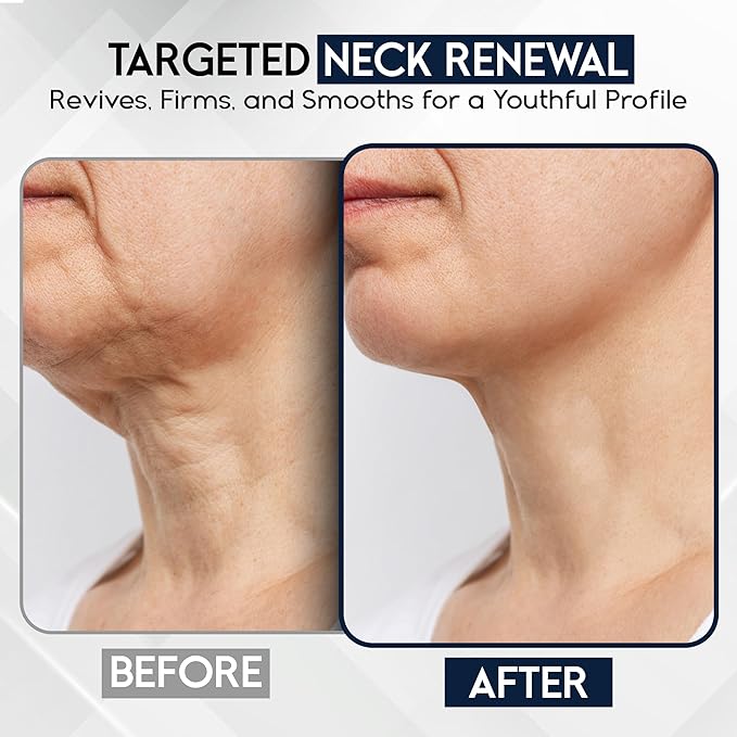 Neck Creams for Tightening and Firming Sagging Skin - Skin Tightening Cream for Face - Decollete & Chest, Under Chin Firming for Older Women - Neck Wrinkles Treatment with Collagen & Hyaluronic Acid