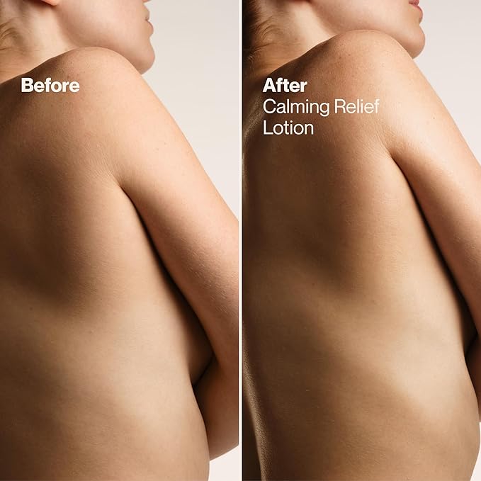 Suave Calming Relief Hand & Body Lotion for Women With Prebiotics For Sensitive Skin, Fragrance & Allergen Free, Helps Restore Skin's Moisture Barrier, 18 FL OZ, 6 Pack