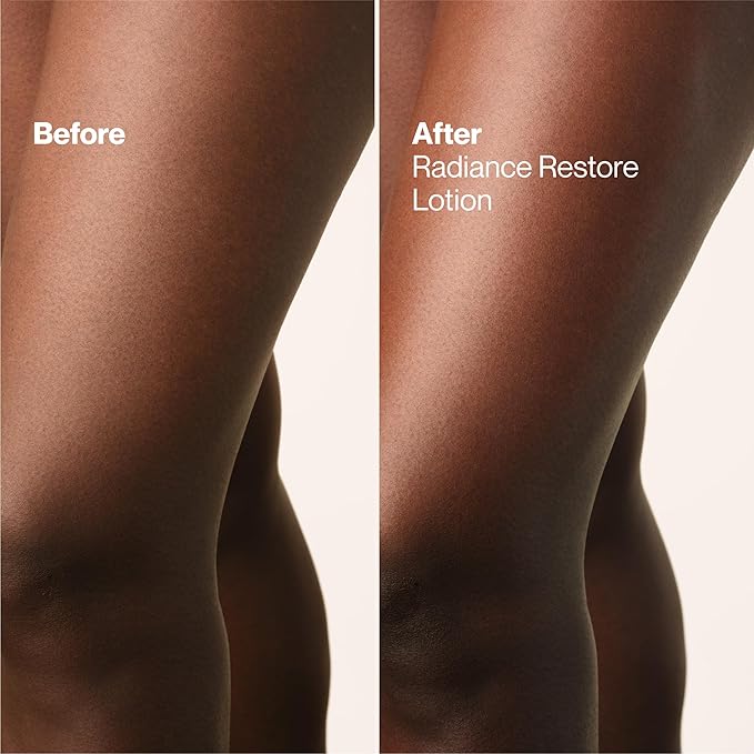 Suave Radiance Restore Hand & Body Lotion For Women With Vitamin C, Brighten & Hydrate Dry, Dull Skin, Non Greasy, Moisturizing Cream Evens Skin Tone, Allergen Free, 28 FL OZ Pump, 4 Pack